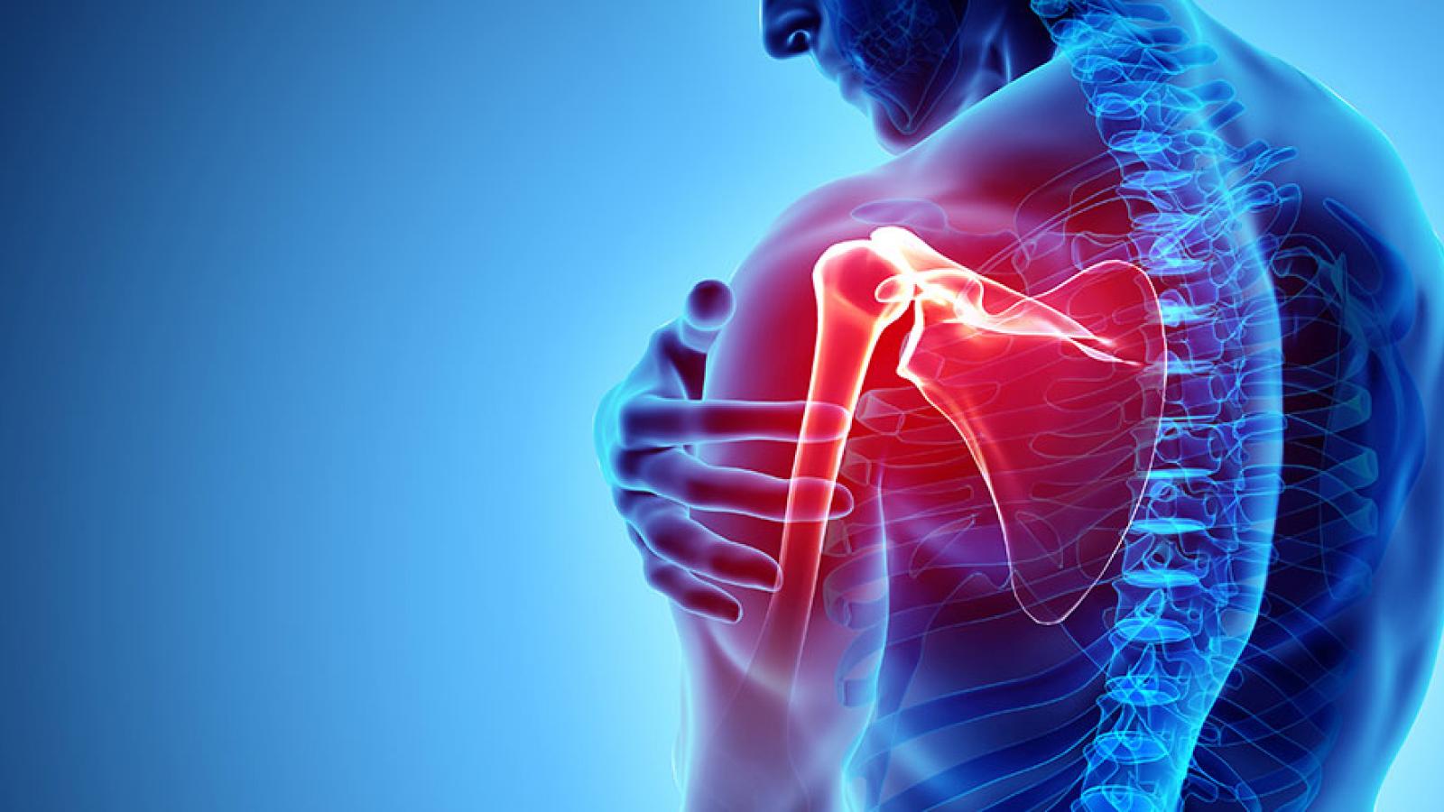 Shoulder Pain: Causes, Treatment, and Tips for Relief